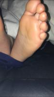 Ticklish soles and toes